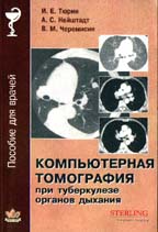 Компьютерная томография при туберкулезе органов дыхания