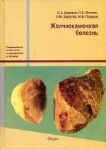 Желчнокаменная болезнь