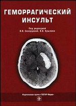 Геморрагический инсульт
