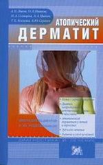 Атопический дерматит