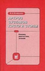 Артроз суставов кисти и стопы