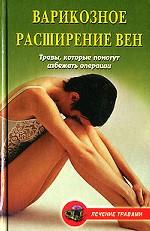 Варикозное расширение вен: травы