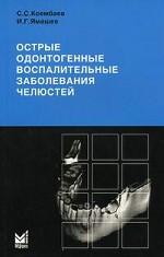 Острые одонтогенные воспалительные заболевания челюстей