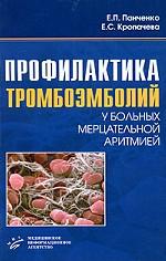 Профилактика тромбоэмболий у больных мерцательной аритмией