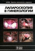 Лапараскопия в гинекологии