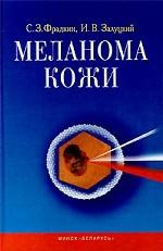 Меланома кожи