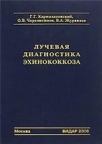 Лучевая диагностика эхинококкоза