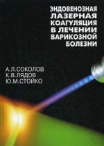 Эндовенозная лазерная коагуляция в лечении варикозной болезни