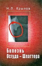 Болезнь Осгуда-Шлаттера