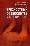 Чрескостный остеосинтез в хирургии стопы