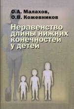 Неравенство длины нижних конечностей у детей (клиническая картина, диагностика, лечение)