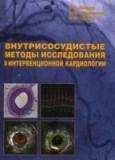 Внутрисосудистые методы исследования в интервенционной кардиологии