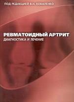 Ревматоидный артрит