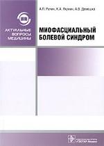 Миофасциальный болевой синдром