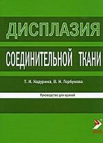 Дисплазия соединительной ткани