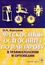 Чрескостный остеосинтез по Илизарову в травматологии и ортопедии