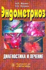 Эндометриоз. Диагностика и лечение