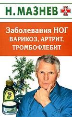 Заболевания ног. Варикоз, артрит, тромбофлебит