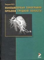 Компьютерная томография органов грудной полости