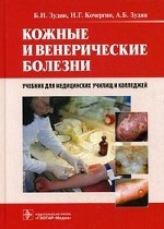 Кожные и венерические болезни. Учебник для медицинских училищ и колледжей. Гриф МО РФ